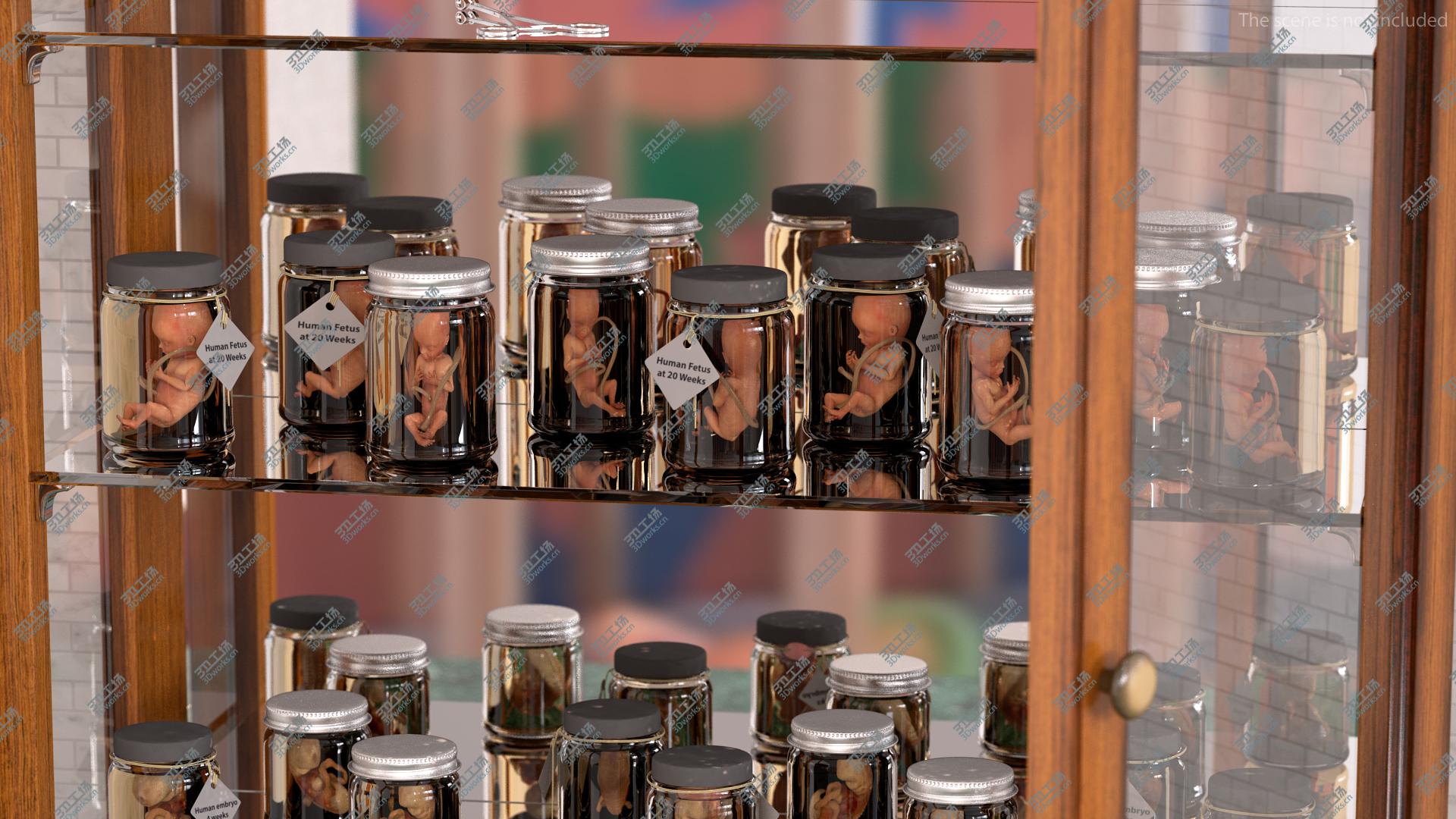 images/goods_img/202104091/3D Human Fetus at 20 Weeks model/5.jpg